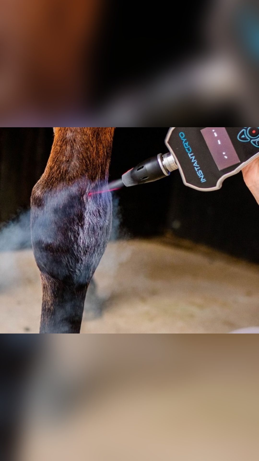 Appareil de cryotherapie InstantCryo, média 5