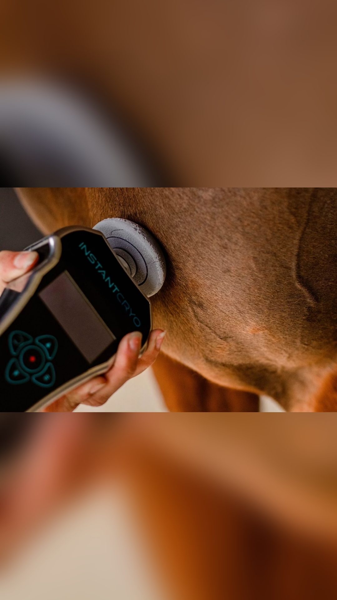 Appareil de cryotherapie InstantCryo, média 9